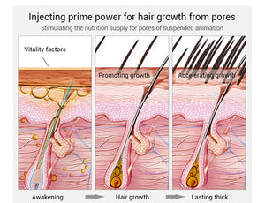 Huiles essentielles pour la croissance des cheveux